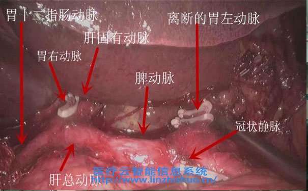 高清手術示教系統