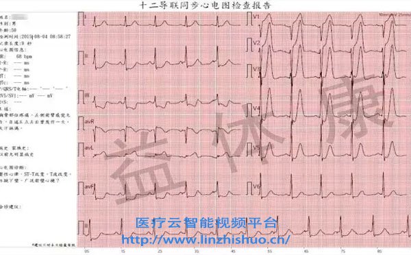 遠程心電會診系統